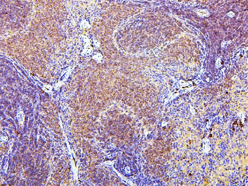 CD43/SPN Mouse Monoclonal Antibody