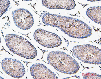 COMT Mouse Monoclonal Antibody