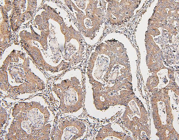 COMT Mouse Monoclonal Antibody