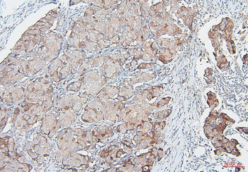 COMT Mouse Monoclonal Antibody