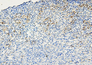 ABCB5 Rabbit Polyclonal Antibody