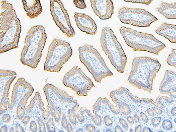 ABCB5 Rabbit Polyclonal Antibody