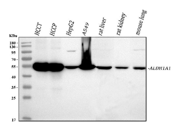 Retinal dehydrogenase 1 ALDH1A1 Rabbit Polyclonal Antibody