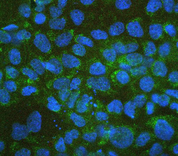 Retinal dehydrogenase 1 ALDH1A1 Rabbit Polyclonal Antibody