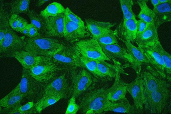 Retinal dehydrogenase 1 ALDH1A1 Rabbit Polyclonal Antibody