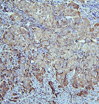 Retinal dehydrogenase 1 ALDH1A1 Rabbit Polyclonal Antibody