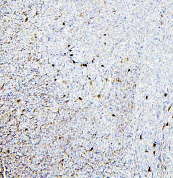 Retinal dehydrogenase 1 ALDH1A1 Rabbit Polyclonal Antibody