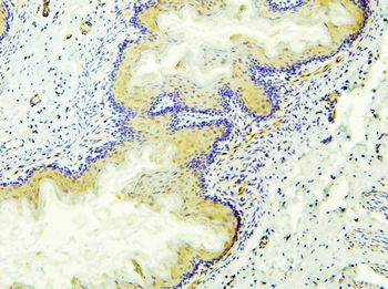 Retinal dehydrogenase 1 ALDH1A1 Rabbit Polyclonal Antibody