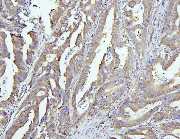 EIF4G1 Rabbit Polyclonal Antibody