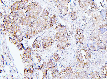 EIF4G1 Rabbit Polyclonal Antibody