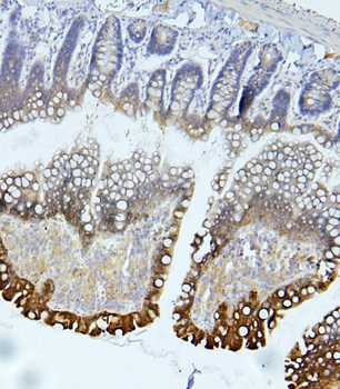 EIF4G1 Rabbit Polyclonal Antibody