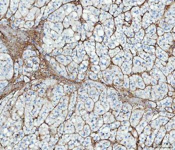 Fibronectin/FN1 Rabbit Polyclonal Antibody