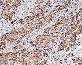 Hexokinase 1/HK1 Rabbit Polyclonal Antibody