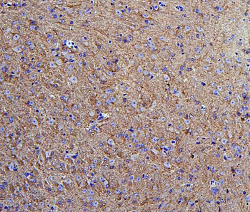 Hexokinase 1/HK1 Rabbit Polyclonal Antibody