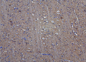 Hexokinase 1/HK1 Rabbit Polyclonal Antibody