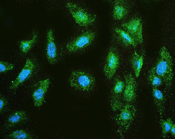 MMP1 Rabbit Polyclonal Antibody