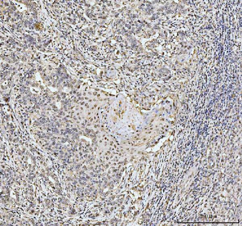 Nucleolin/NCL Rabbit Polyclonal Antibody