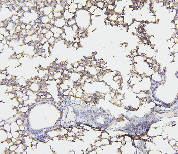 NF2/Merlin Antibody