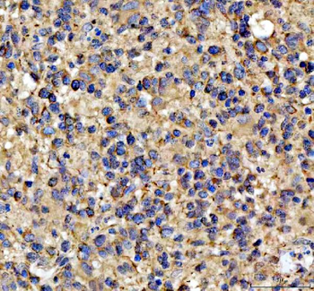 NOTCH2 Rabbit Polyclonal Antibody