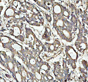 NOTCH2 Rabbit Polyclonal Antibody