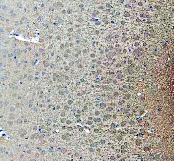 NOTCH2 Rabbit Polyclonal Antibody