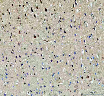 NOTCH2 Rabbit Polyclonal Antibody