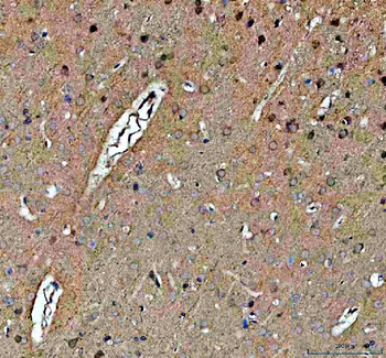 NOTCH2 Rabbit Polyclonal Antibody