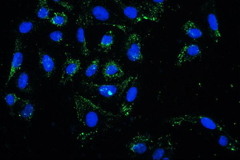 PKC delta/PRKCD Rabbit Polyclonal Antibody