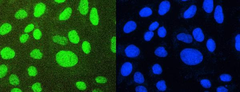 PTBP1 Rabbit Polyclonal Antibody