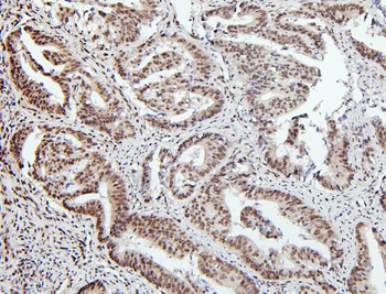 PTBP1 Rabbit Polyclonal Antibody