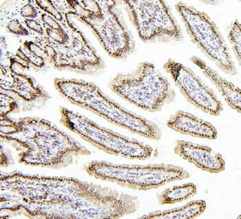 PTBP1 Rabbit Polyclonal Antibody