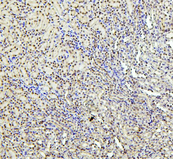 PTBP1 Rabbit Polyclonal Antibody