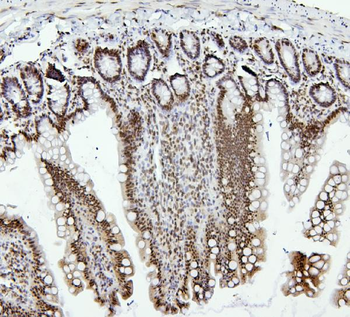 PTBP1 Rabbit Polyclonal Antibody