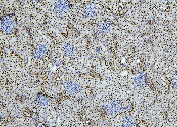 PTBP1 Rabbit Polyclonal Antibody