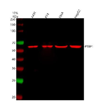 PTBP1 Rabbit Polyclonal Antibody