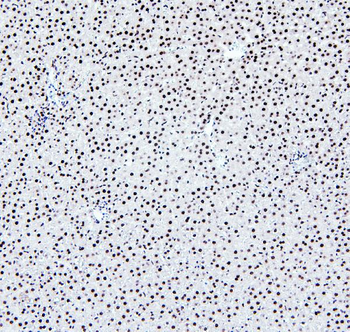 PTBP2 Rabbit Polyclonal Antibody
