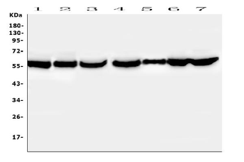 PTBP2 Rabbit Polyclonal Antibody