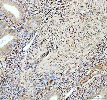 Fox2/RBM9/RBFOX2 Rabbit Polyclonal Antibody