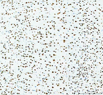 Fox2/RBM9/RBFOX2 Rabbit Polyclonal Antibody