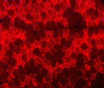 Troponin I fast skeletal muscle/TNNI2 Antibody