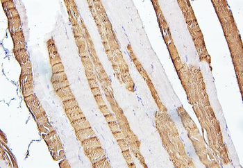 Troponin I fast skeletal muscle/TNNI2 Antibody
