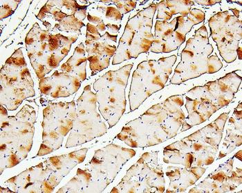 Troponin I fast skeletal muscle/TNNI2 Antibody