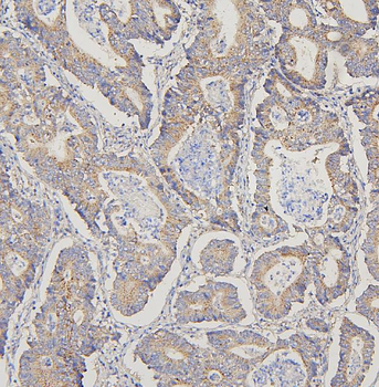 TRPV3 Rabbit Polyclonal Antibody