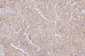 Thioredoxin 2/TXN2 Antibody