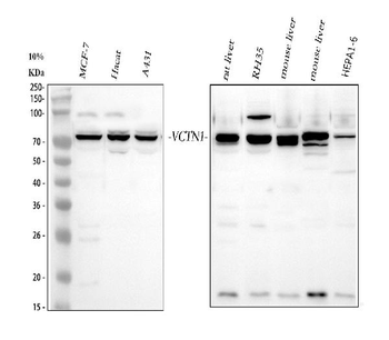 B7H4/VTCN1 Antibody