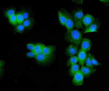 Aldolase/ALDOA Rabbit Polyclonal Antibody