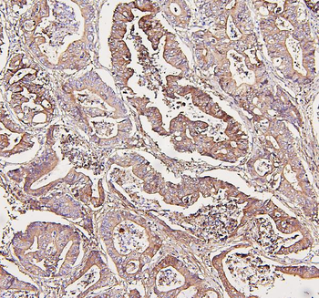 Aldolase/ALDOA Rabbit Polyclonal Antibody