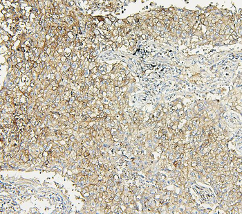 Aldolase/ALDOA Rabbit Polyclonal Antibody
