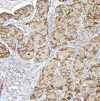 Aldolase/ALDOA Rabbit Polyclonal Antibody