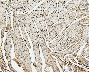 Aldolase/ALDOA Rabbit Polyclonal Antibody